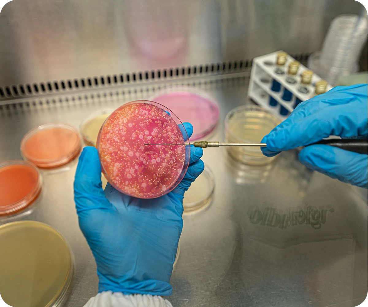 analisi isolamento colonie tipiche alimenti igienstudio laboratorio analisi jesi
